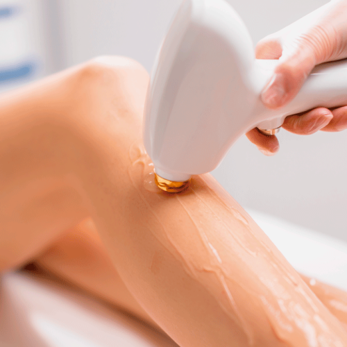 Depilacion-laser-Todo-lo-que-debes-saber-sobre-la-depilacion